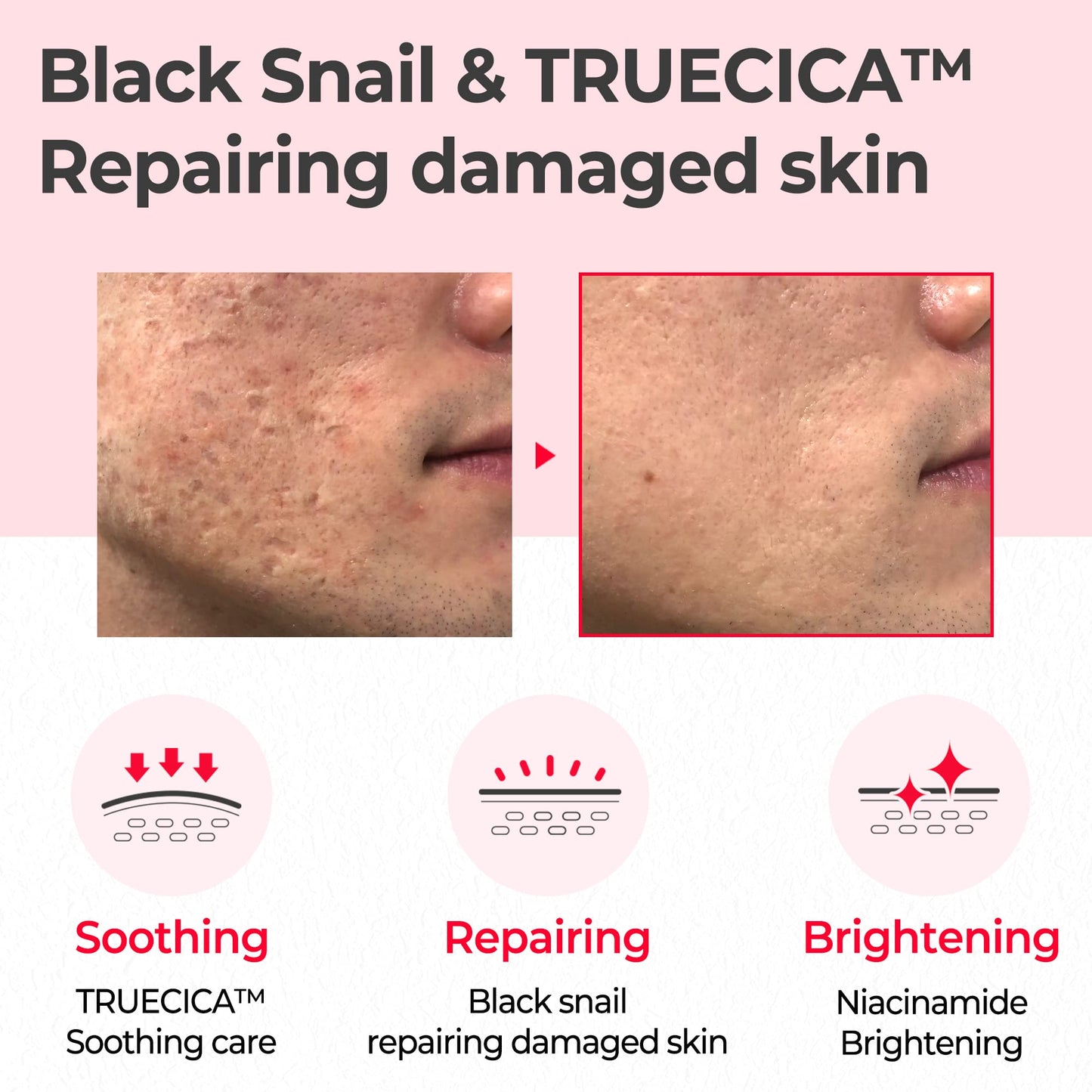 Snail Truecica Miracle Repair Toner de Somebymi